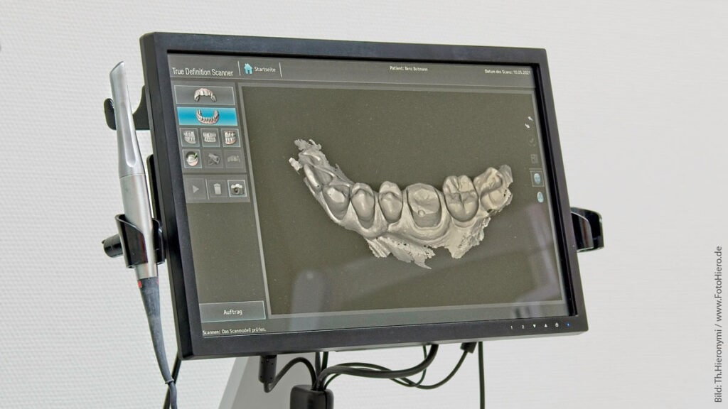 Zahnarzt Botmann - True Definition Scanner